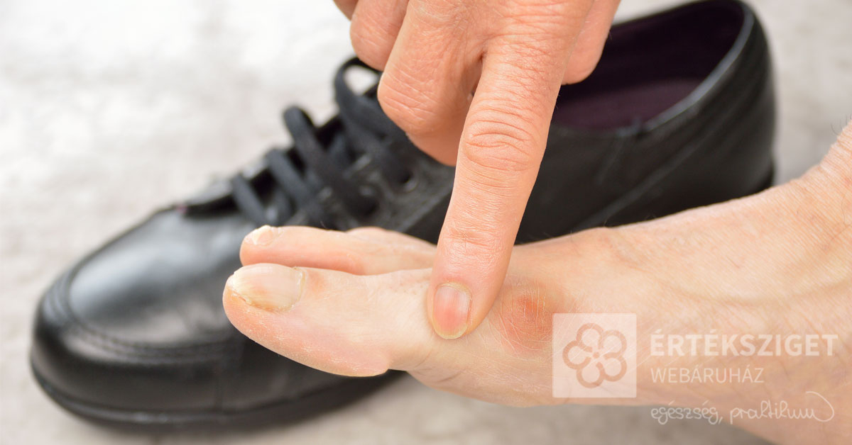 láb zúzódás kezelése artrózis oxigénkezelés