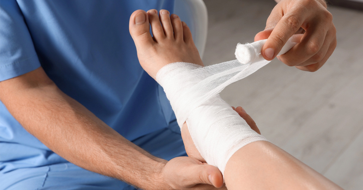 Fekélyes láb: tünetek, okok, kezelés és megelőzés