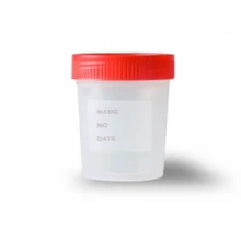 Vizeletes pohár csavaros tetővel, steril, 100ml