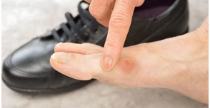 A nagylábujj fájdalom egyre többeket érint - Ön is köztük van?