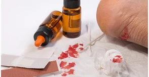 Sebgyógyulás gyorsítása házilag – 12 hasznos tanács, ami segíteni fog