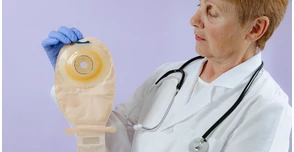 Sztóma műtét – időpont, menet és felépülés