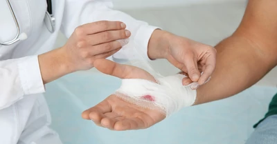 Égési seb kezelése otthon – tünetek, elsősegély és megelőzés