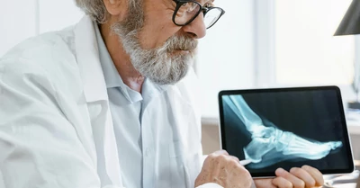 Mozgásszervi problémák a mindennapokban: így segíthet az ortopédia és a tudatos életmód