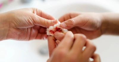 A sebfertőzés jelei, megelőzése és hatékony kezelési lehetőségei