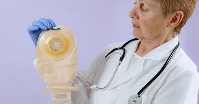 Sztóma műtét – időpont, menet és felépülés