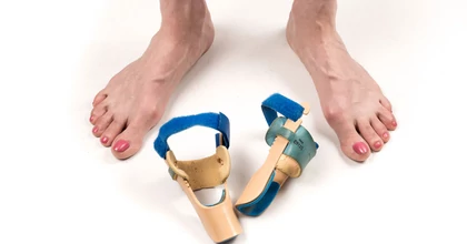 A kalapácsujj tünetei és kezelése