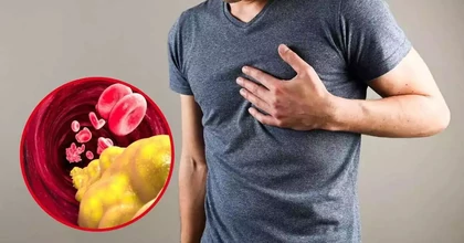 Koleszterin mérés otthon: milyen értékekre kell odafigyelni?