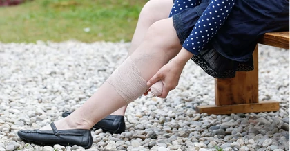 Mit tehetünk otthon a fésű ödéma enyhítésére?