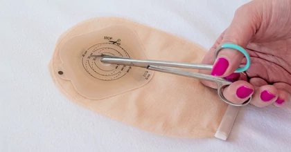 Tippek, trükkök, tanácsok sztómásoknak a mindennapi rutinhoz