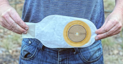 A sztómazsák cseréje alkalmával is kiemelten figyeljen a higiéniára